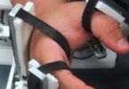 Роботизированная терапия помогает при параличе