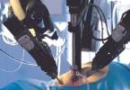 Робототехника в хирургии