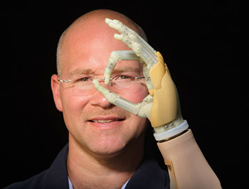 Touch Bionics iLimb Hand