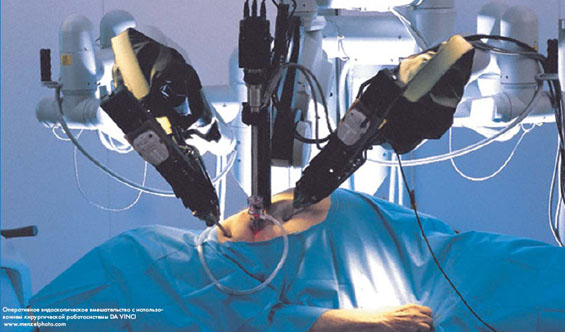 Робототехника в хирургии