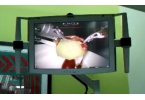 Хирургический робот Da Vinci чистит виноградину