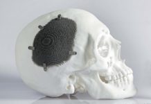 Резидент технопарка «Мосгормаш» начал производить 3D-печатные имплантаты