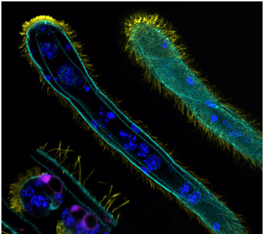 Ортонектиды и дициемиды: единая группа или альтернативные пути упрощения?