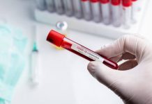 Мнение вирусолога: можно ли второй раз заразиться CoVID-19? Мнение вирусолога: можно ли второй раз заразиться CoVID-19