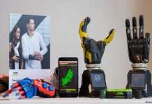 Протезы компании «Моторика» выйдут на европейский рынок