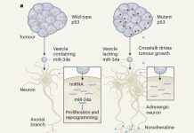 Потеря опухолью белка p53 способствует росту в ней нервных волокон