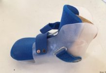 Реальное применение: 3D-сканирование в ортопедической практике