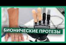 Бионические протезы: когда люди станут киборгами?
